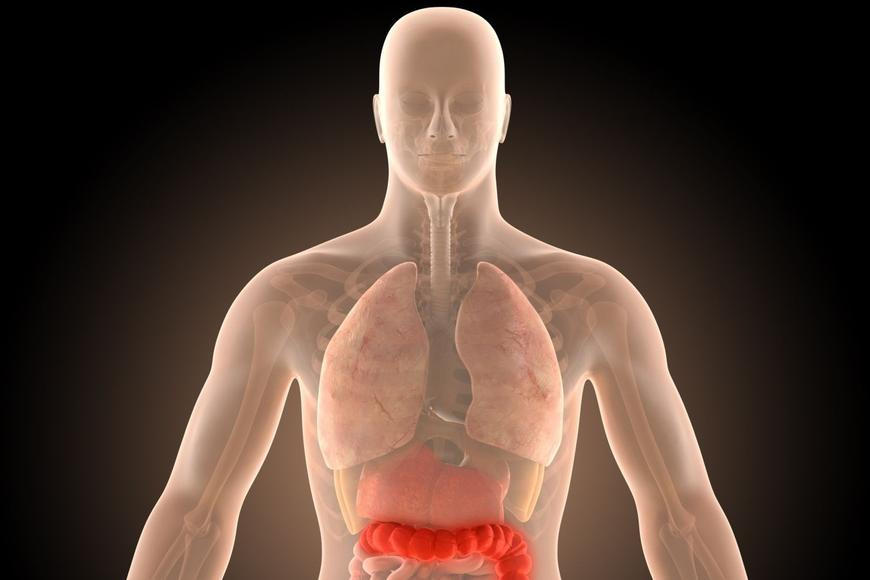 Půlka Čechů má ve střevě polypy. „Zbavte se jich, přerůstají v rakovinu," radí lékař
