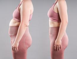 Tummy,Tuck,,Female,Fat,Body,Before,And,After,Weight,Loss