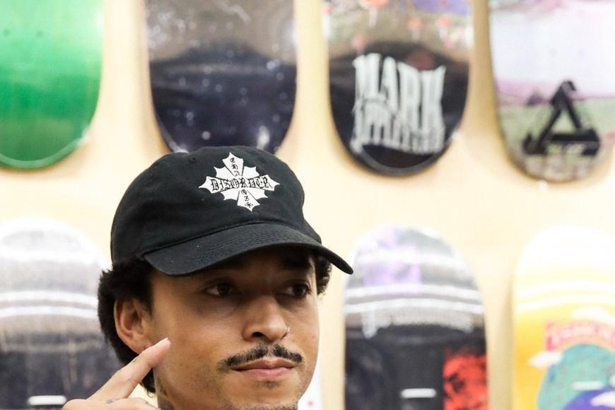 Nic pro slabé nátury. Skateboardová superstar si při pádu zlomila lebku a očnici