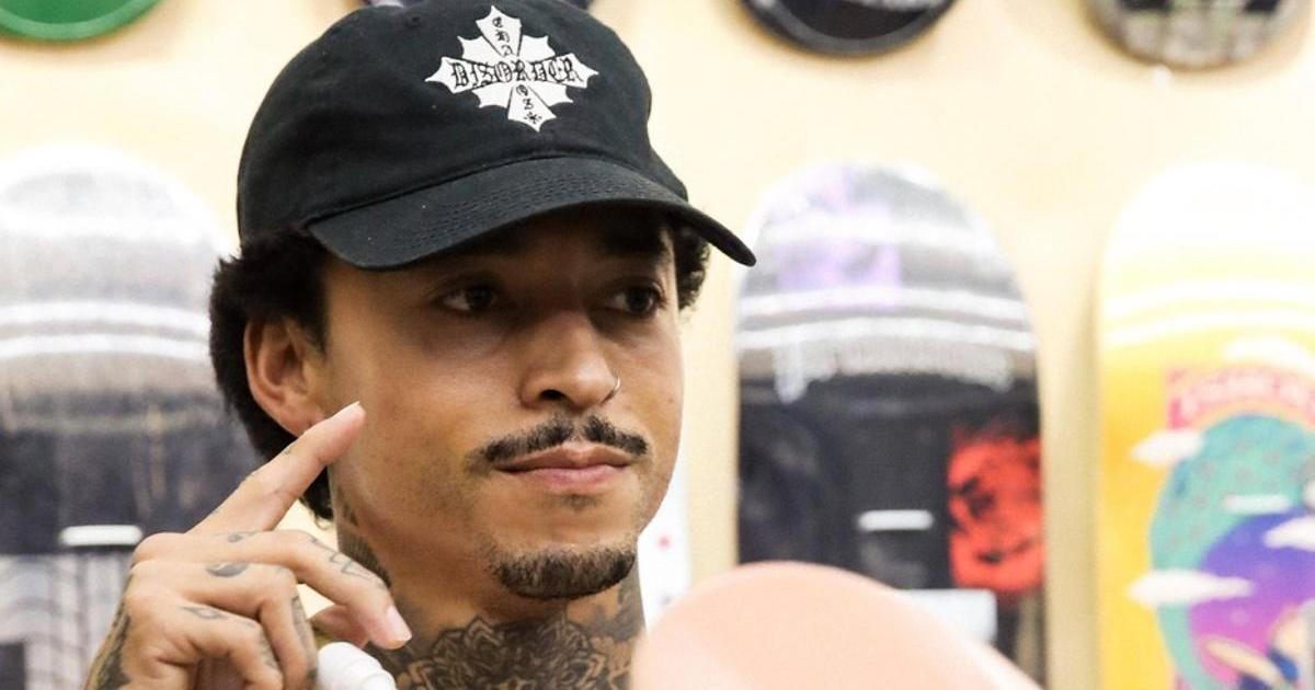 Nic pro slabé nátury. Skateboardová superstar si při pádu zlomila lebku a očnici