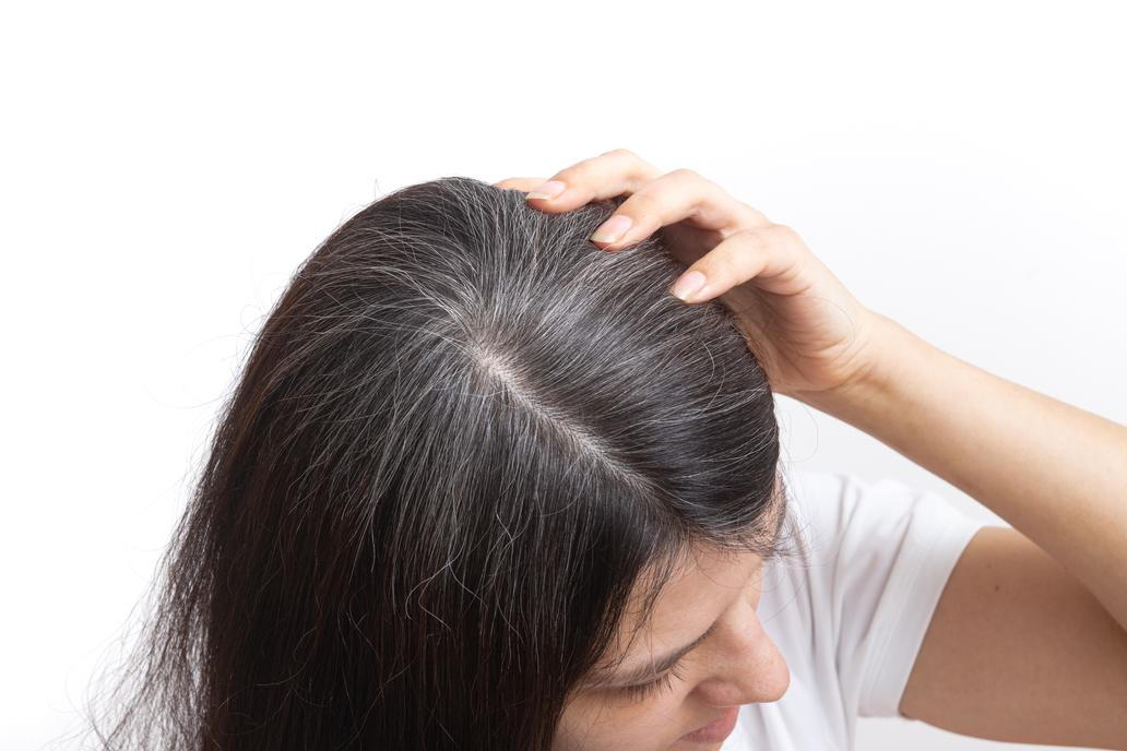 A,Young,Woman,With,Gray,Hair.,Early,Gray,Hair,Concept.