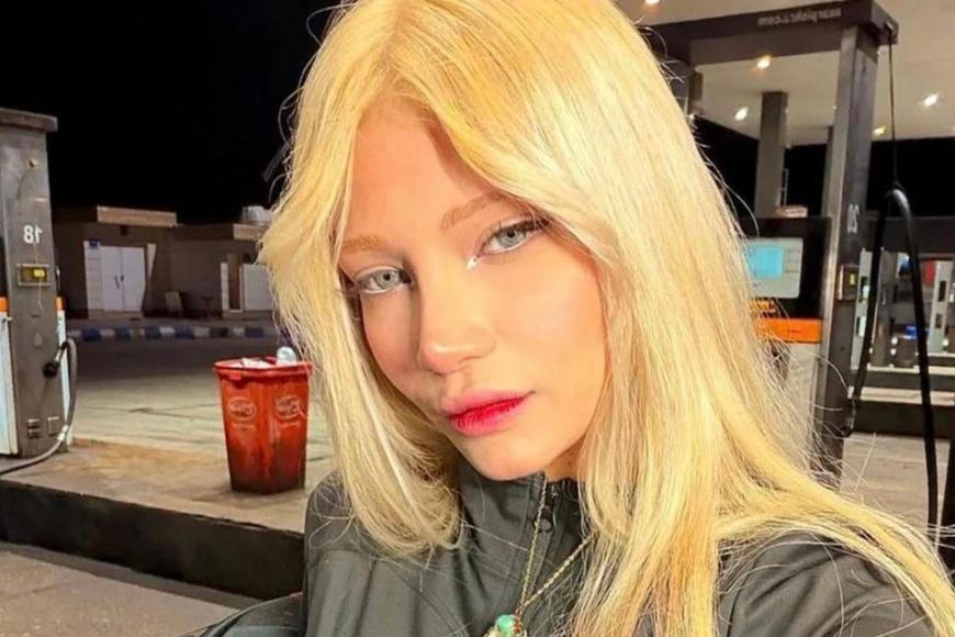 Devatenáctiletá Diana se stala obětí brutálního zásahu. „Nehoda,“ tvrdí íránský režim