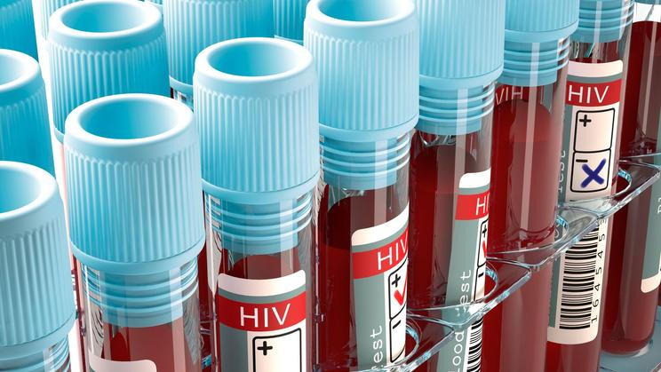 HIV test