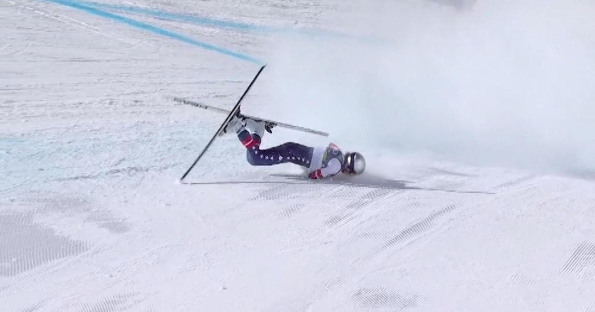 Čeká mě mnoho operací, přiznala Vonnová. Prozradila i děsivou diagnózu