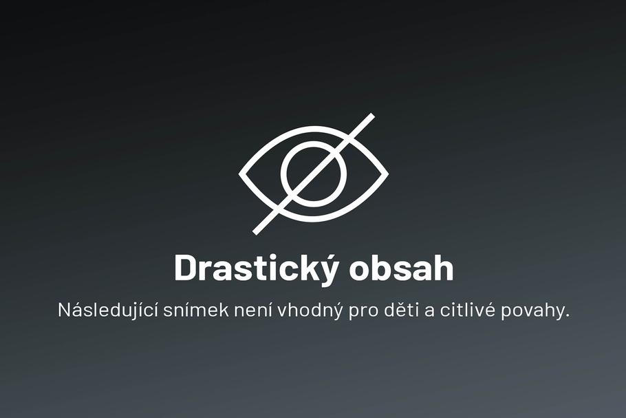 Drastický obsah, následující snímek není vhodný pro děti a citlivé povahy