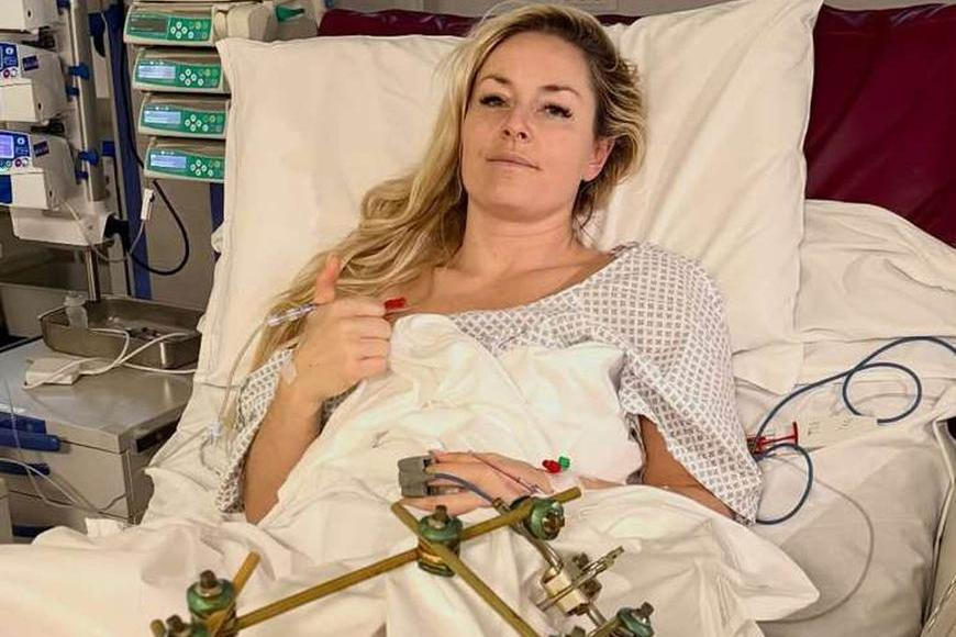 Další velká rána pro zraněnou Vonnovou: lyžařka přišla o milovaného parťáka