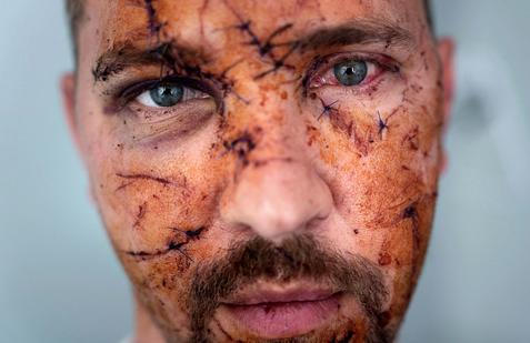 Tváře odvahy a bolesti: čtyři roky od začátku ruské invaze na Ukrajinu