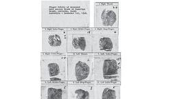 Otisky prstů neznámého muže nalezeného 1. prosince 1948 na pláži Somerton v australském Adelaide. Snímky byly pořízeny během vyšetřování. 