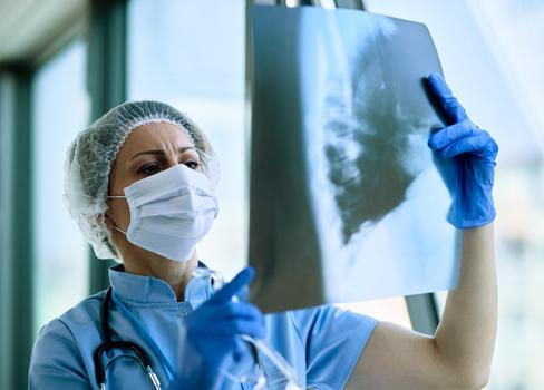 „Je to časovaná bomba,“ říká o lidech s neléčenou tuberkulózou pneumolog Jiří Votruba.