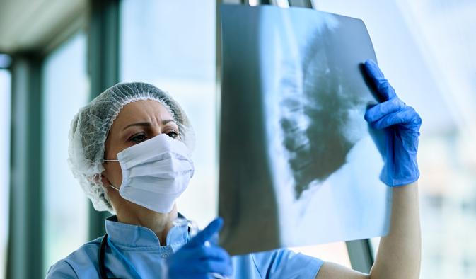 „Je to časovaná bomba,“ říká o lidech s neléčenou tuberkulózou pneumolog Jiří Votruba.