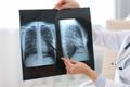 Lung,Disease.,Doctor,Examining,Chest,X-ray,In,Clinic,,Closeup