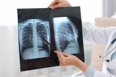 Lung,Disease.,Doctor,Examining,Chest,X-ray,In,Clinic,,Closeup