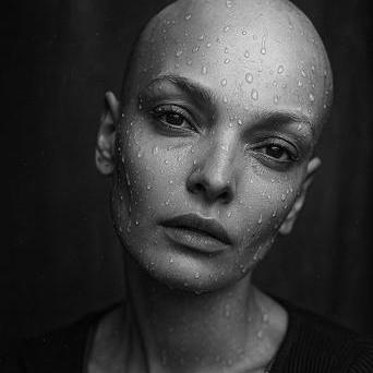 Zpráva, která jí navždy změnila život, přišla pouhý týden před Vánoci. Snímek odhalil na plicích podezřelý útvar.