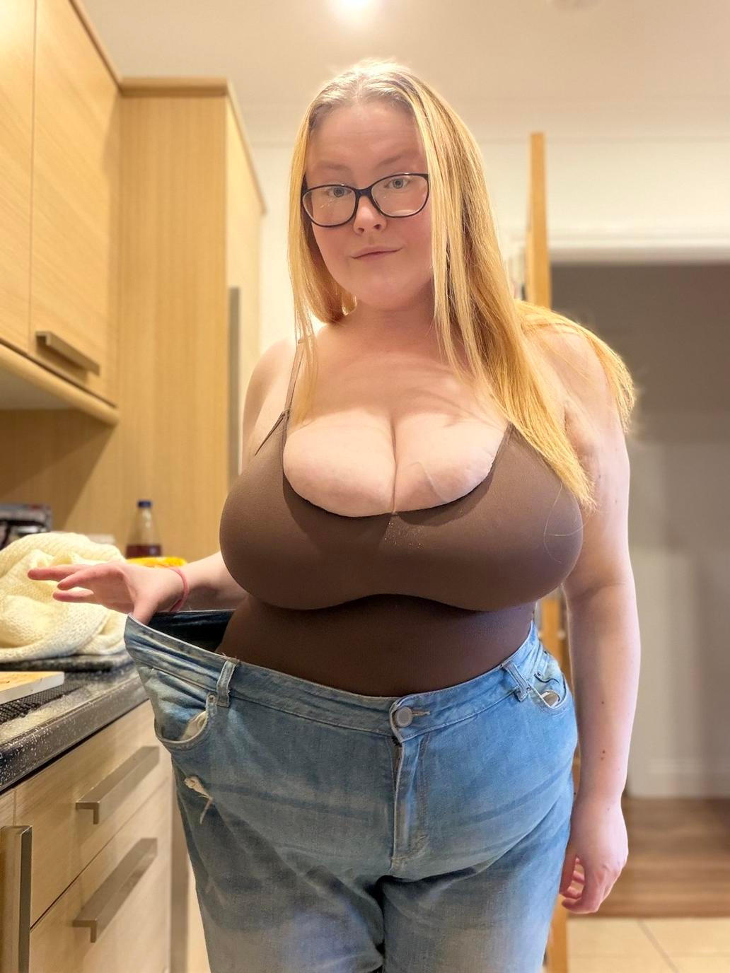 Tianna Moon krásně zhubla a pas má štíhlý, prsa ale nepřestávají růst. Woman's NN-cup boobs won't stop growing due to rare condition