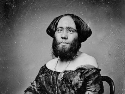  Josephine Clofullia (1829–1870) byla slavná vousatá dáma švýcarského původu, která se proslavila především tím, že byla součástí „Amerického muzea“ P. T. Barnuma