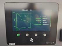Celková křivka je více než příznivá, z 10 na 80 procent zvládnete baterku dobít za méně než 21 minut.