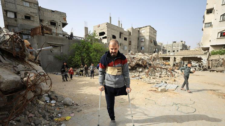 Palestinian amputee Hazem Foura, who lost one leg, walks using crutches in a street in Gaza