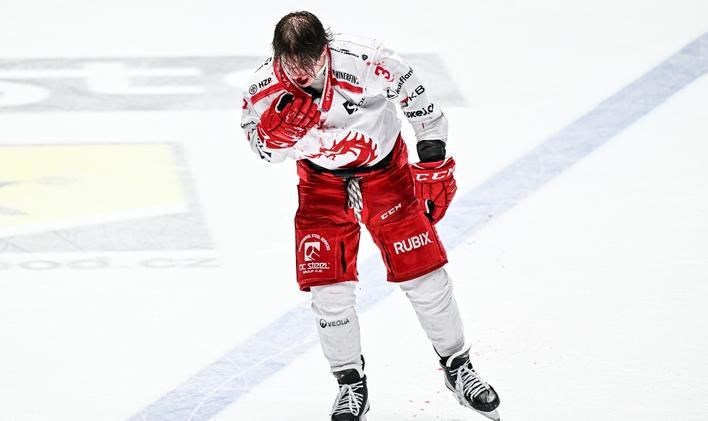 Petr Sikora, hokejista, sportovec, zranění, krev, potyčka, bitka
