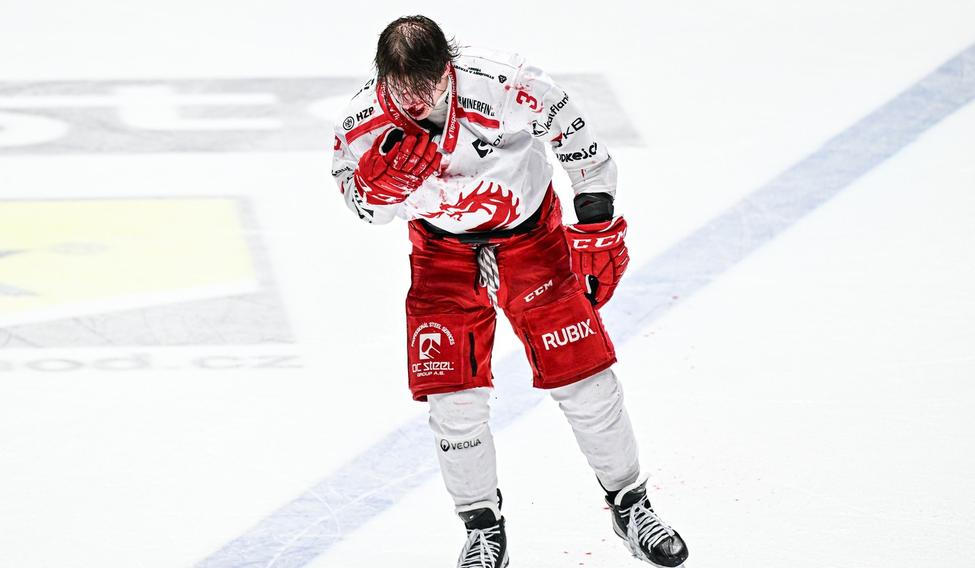 Petr Sikora, hokejista, sportovec, zranění, krev, potyčka, bitka