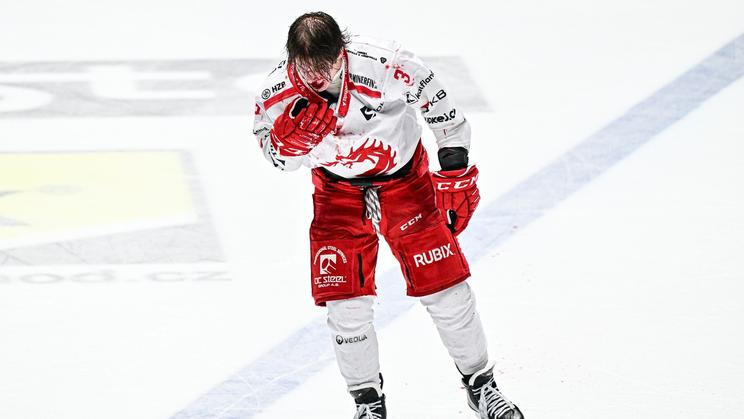 Petr Sikora, hokejista, sportovec, zranění, krev, potyčka, bitka