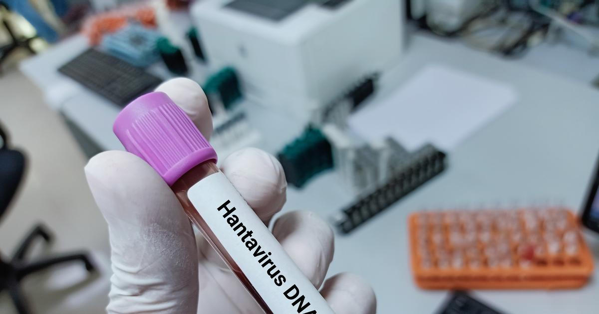 Na výletní lodi s hantavirem zřejmě není žádný český občan, oznámili hygienici