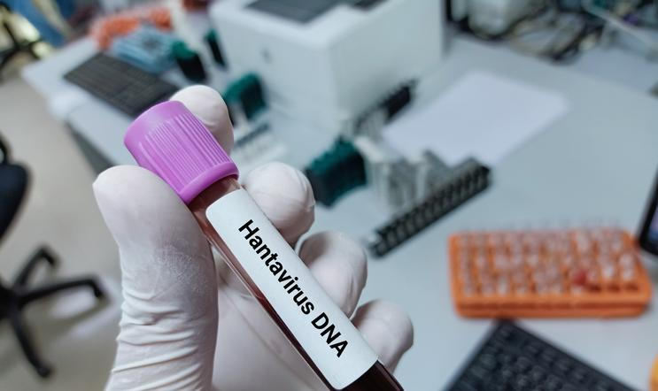 Lab,Technologist,Hold,Blood,Sample,For,Hantavirus,Dna,Test.,Laboratory