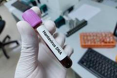 Lab,Technologist,Hold,Blood,Sample,For,Hantavirus,Dna,Test.,Laboratory
