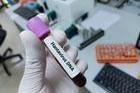Lab,Technologist,Hold,Blood,Sample,For,Hantavirus,Dna,Test.,Laboratory