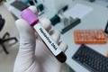 Lab,Technologist,Hold,Blood,Sample,For,Hantavirus,Dna,Test.,Laboratory