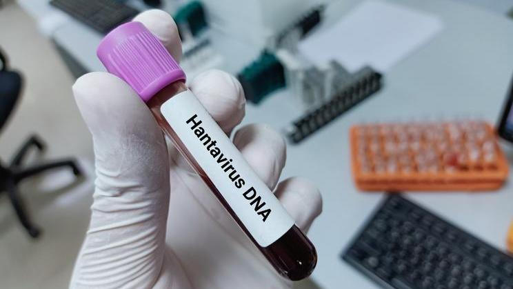Lab,Technologist,Hold,Blood,Sample,For,Hantavirus,Dna,Test.,Laboratory
