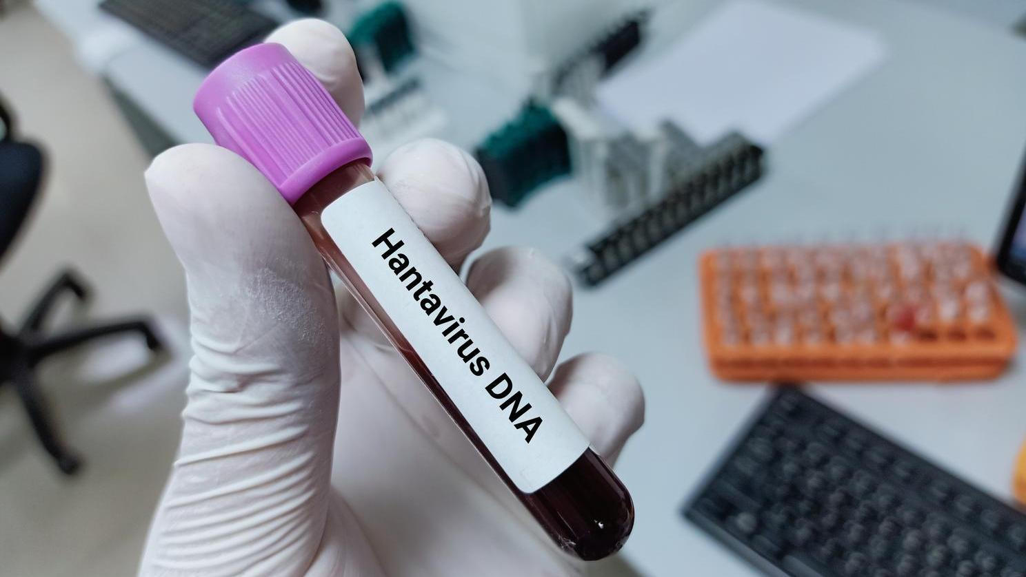 Odkud se hantavirus dostal na výletní loď? Stopa vede do Ohňové země ...