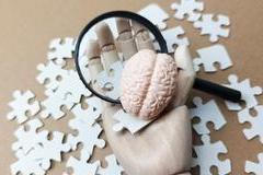 Exploring,Alzheimer?s,Disease,And,Memory,Loss,Concept,Showing,Diagnosis,,Prevention,