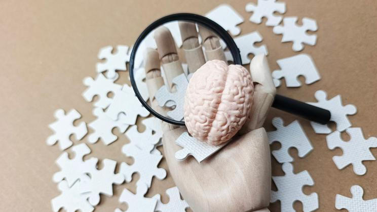 Exploring,Alzheimer?s,Disease,And,Memory,Loss,Concept,Showing,Diagnosis,,Prevention,