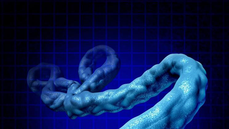 ebola virus