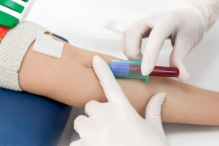Lidí, kteří darují krev, ubývá. Nemocnice kvůli věku musí vy