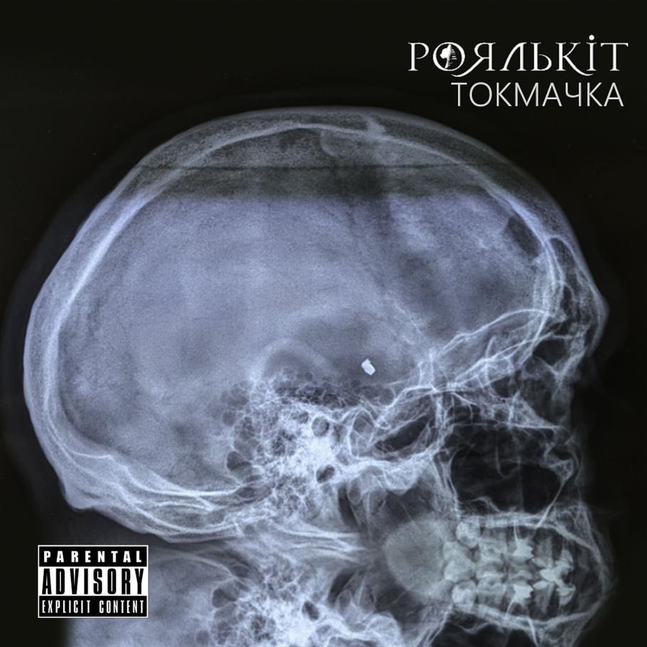 Bývalý voják a hudebník Roman „Roxas“ Haman složil písničku o obraně Malé Tokmačky a na přebal použil snímek z rentgenu vlastní lebky s kusem šrapnelu.