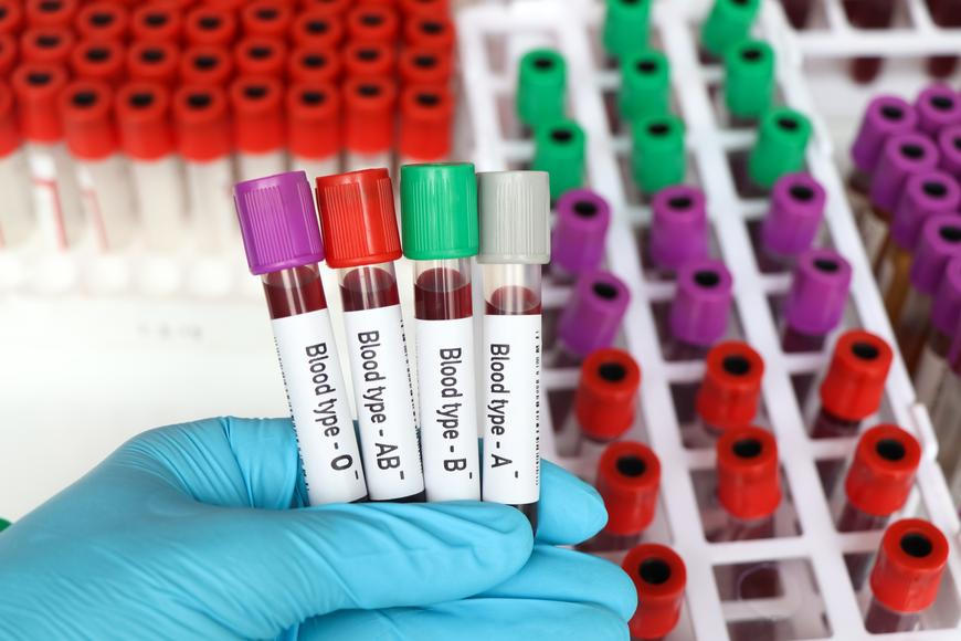 Největší analýza svého druhu ukázala, která krevní skupina může zvyšovat riziko cukrovky