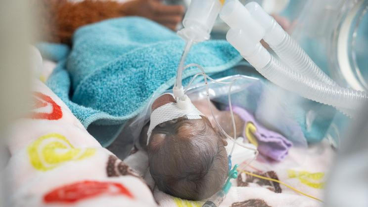 Zoo v Tchaj-peji oznámila unikátní přírůstek. Císařským řezem se tam narodila orangutaní dvojčata. Jedno z nich ale záhy uhynulo