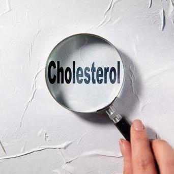Cholesterol