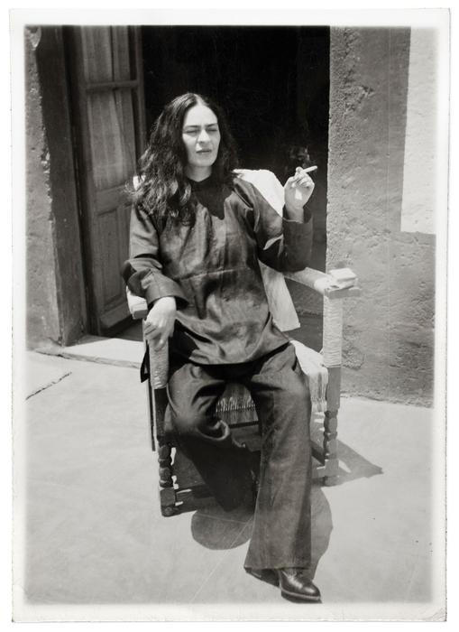 Antonio Kahlo: Frida Kahlo po operaci