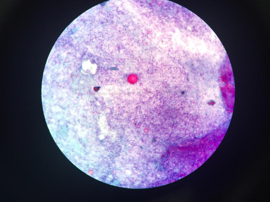 Mikroskopický parazit, o kterém většina lidí nikdy neslyšela, letos v létě zaměstnává americké epidemiology.