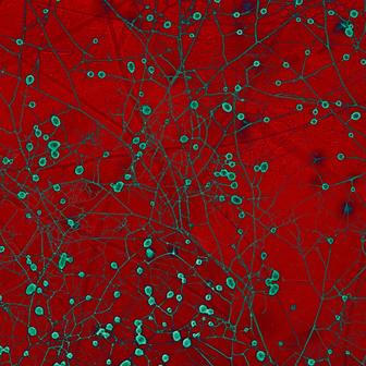 Mykorhizní houby pod mikroskopem Morrison v institutu AMOLF (Institute of Complex Materials) v Amsterdamu, 12. září 2025. Kruhové útvary jsou spory. Původní snímek je černobílý, barva byla upravena pro lepší čitelnost. 