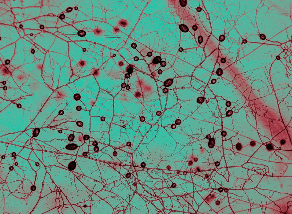 Mykorhizní houby pod mikroskopem Morrison v institutu AMOLF (Institute of Complex Materials) v Amsterdamu, 12. září 2025. Kruhové útvary jsou spory. Původní snímek je černobílý, barva byla upravena pro lepší čitelnost.