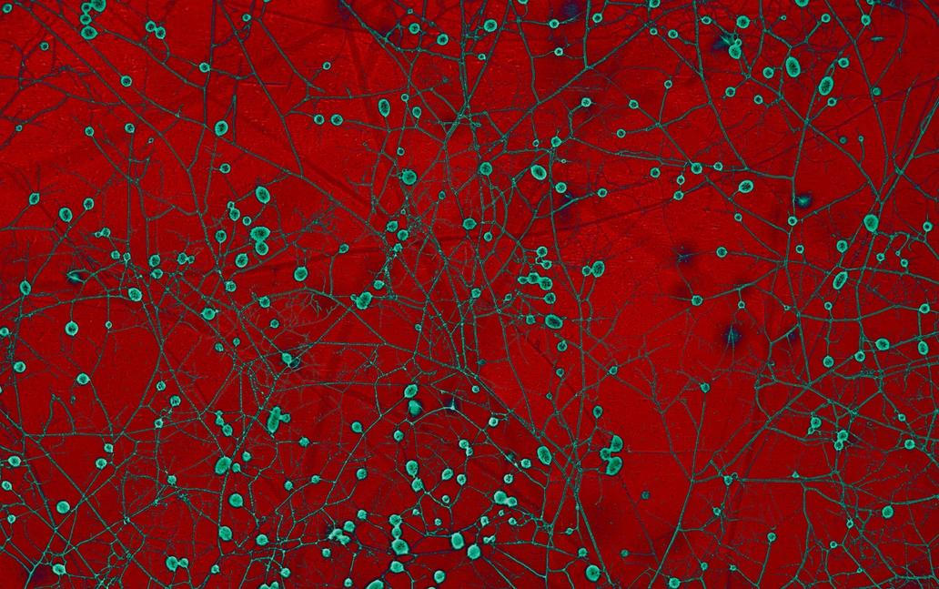 Mykorhizní houby pod mikroskopem Morrison v institutu AMOLF (Institute of Complex Materials) v Amsterdamu, 12. září 2025. Kruhové útvary jsou spory. Původní snímek je černobílý, barva byla upravena pro lepší čitelnost. 