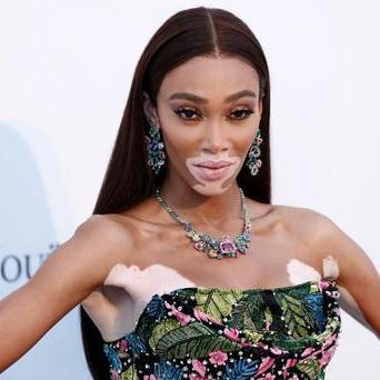 Winnie Harlow