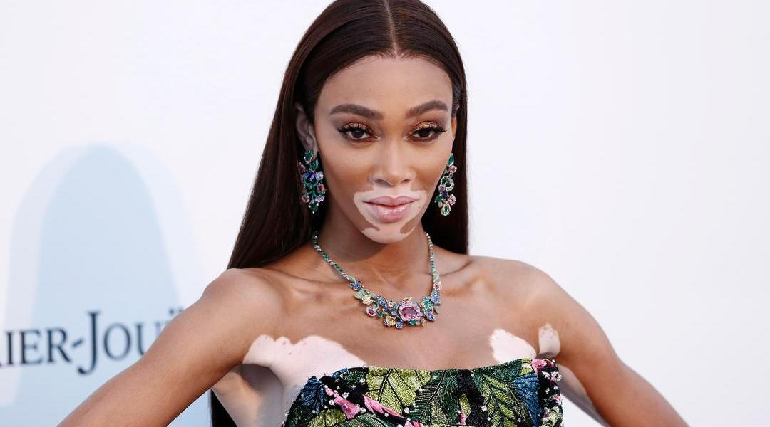 Winnie Harlow