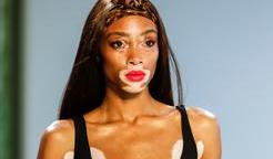 Winnie Harlow