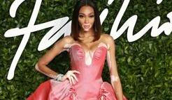 Winnie Harlow