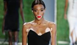 Winnie Harlow