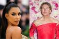 Kim Kardashian, Renée Zellweger a další hvězdy tvrdí, že na plastice nebyly